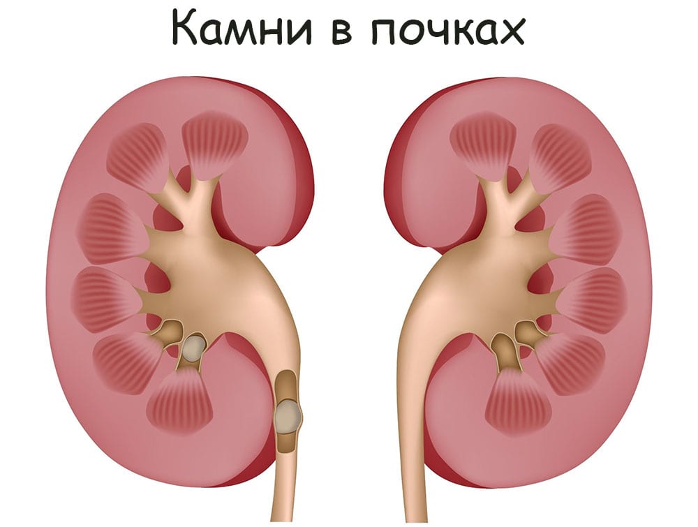 Сайт кракен закрыли